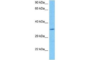 Host:  Mouse  Target Name:  DAZL  Sample Tissue:  Mouse Brain  Antibody Dilution:  1ug/ml (DAZL antibody  (C-Term))