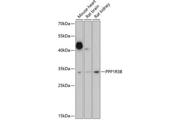 PPP1R3B 抗体  (AA 1-140)