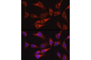 Immunofluorescence analysis of NIH/3T3 cells using FAK Rabbit pAb (ABIN6134667, ABIN6146423, ABIN6146425 and ABIN6215105) at dilution of 1:100 (40x lens). (FAK antibody  (AA 700-800))
