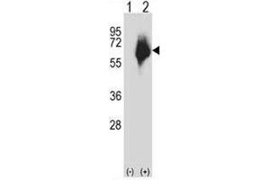Western blot analysis of MMP2 antibody and 293 cell lysate either nontransfected (Lane 1) or transiently transfected (2) with the MMP2 gene. (MMP2 antibody  (AA 303-331))