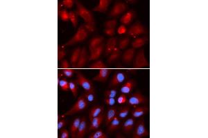 Immunofluorescence analysis of U2OS cells using PSMB2 antibody (ABIN5973193). (PSMB2 antibody)