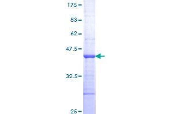 TNNI3K Protein (AA 371-470) (GST tag)