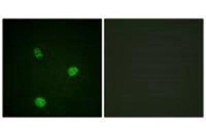 Immunofluorescence analysis of HeLa cells, using MITF (Ab-180/73) antibody. (MITF antibody  (Ser73, Ser180))