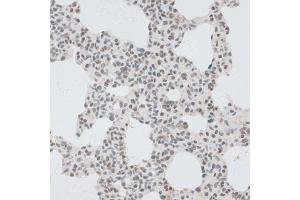 Immunohistochemistry of paraffin-embedded rat brain using ZNF148 antibody (ABIN6130815, ABIN6150463, ABIN6150464 and ABIN6222770) at dilution of 1:100 (40x lens). (ZNF148 antibody  (AA 690-794))