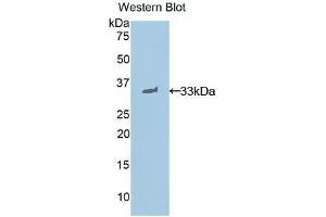 Western Blotting (WB) image for anti-Signal Transducer and Activator of Transcription 1, 91kDa (STAT1) (AA 432-680) antibody (ABIN1860645)