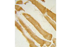 Formalin-fixed and paraffin-embedded human skeletal muscle reacted with ITPKC Antibody (N-term), which was peroxidase-conjugated to the secondary antibody, followed by DAB staining. (ITPKC antibody  (N-Term))