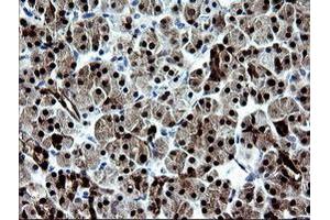 Image no. 1 for anti-Cytidine Monophosphate (UMP-CMP) Kinase 1, Cytosolic (CMPK1) antibody (ABIN1497542) (Cytidine Monophosphate (UMP-CMP) Kinase 1, Cytosolic (CMPK1) antibody)