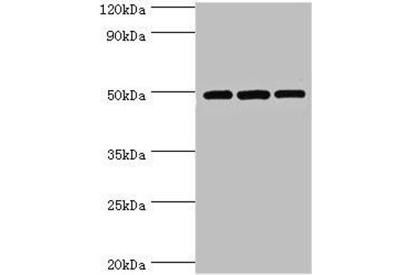 DCP2 anticorps  (AA 1-240)