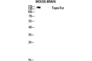 Western Blot (WB) analysis of Mouse Brain lysis using Topo IIalpha antibody. (Topo IIalpha (Tyr174) antibody)