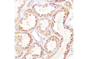 Immunohistochemistry of paraffin-embedded rat kidney using DLDH/DLD Rabbit mAb (ABIN7266766) at dilution of 1:100 (40x lens). (DLD antibody)
