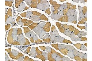 ABIN7094266 and ABIN7098313 at 1/100 staining mouse muscle tissue by IHC-P. (Golgin A3 antibody  (Internal Region))