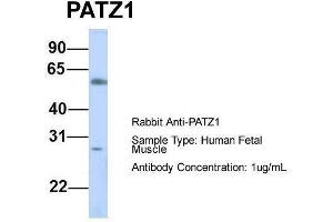 Host:  Rabbit  Target Name:  PATZ1  Sample Type:  Human Fetal Muscle  Antibody Dilution:  1. (PATZ1 antibody  (N-Term))