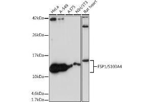 Western blot analysis of extracts of various cell lines, using FSP1/S100 antibody (ABIN7270125) at 1:1000 dilution.