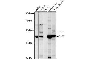 Western blot analysis of extracts of various cell lines, using TdT antibody (ABIN6130878, ABIN6139759, ABIN6139760 and ABIN6221856) at 1:500 dilution. (TdT antibody  (AA 260-509))