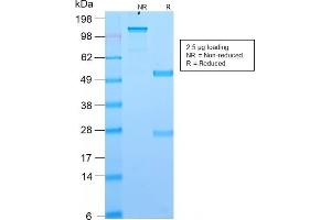 SDS-PAGE Analysis Purified DOG-1 Rabbit Recombinant Monoclonal Antibody (DG1/2564R). (Recombinant ANO1 antibody  (AA 2-101))