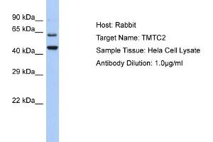 Host: Rabbit Target Name: TMTC2 Sample Type: Hela Whole cell lysates Antibody Dilution: 1. (TMTC2 antibody  (C-Term))