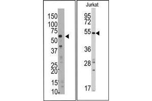 Image no. 1 for anti-SMYD Family Member 5 (SMYD5) (C-Term) antibody (ABIN358724) (SMYD5 antibody  (C-Term))