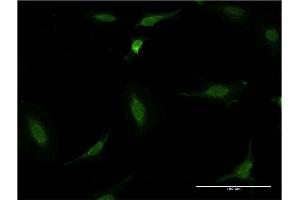 Immunofluorescence of monoclonal antibody to CDR2 on HeLa cell. (CDR2 antibody  (AA 296-404))