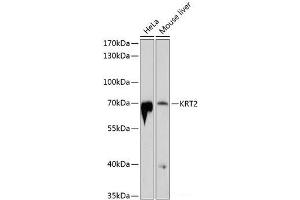 Western blot analysis of extracts of various cell lines using KRT2 Polyclonal Antibody at dilution of 1:1000. (Keratin 2 antibody)
