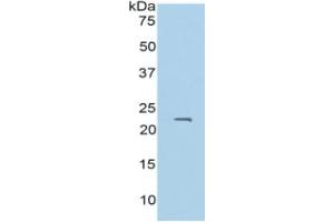 WB of Protein Standard: different control antibodies  against Highly purified E. (PROS1 ELISA Kit)