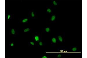 Immunofluorescence of monoclonal antibody to HDAC1 on HeLa cell. (HDAC1 antibody  (AA 1-482))