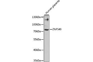 Western blot analysis of extracts of Human placenta, using ZNF549 antibody (ABIN4905684).