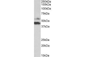 ABIN5539924 (1µg/ml) staining of Human Colorectal Cancer lysate (35µg protein in RIPA buffer). (PYROXD1 antibody  (N-Term))