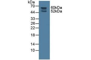 Detection of NOSTRIN in Rat Lung Tissue using Polyclonal Antibody to Nitric Oxide Synthase Trafficker (NOSTRIN) (NOSTRIN antibody  (AA 1-245))