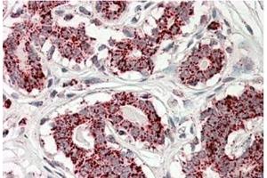 AP23725PU-N ACO2 Antibody staining of paraffin embedded Human Breast at 3. (ACO2 antibody  (Internal Region))