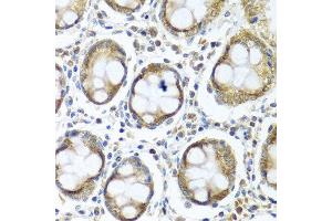 Immunohistochemistry of paraffin-embedded human colon using IFI44 antibody at dilution of 1:100 (40x lens). (IFI44 antibody)