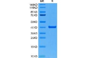 Mouse ANXA2 on Tris-Bis PAGE under reduced condition. (Annexin A2 Protein (ANXA2) (AA 2-339) (His tag))