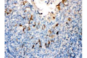 IHC analysis of Filaggrin using anti-Filaggrin antibody (ABIN3044525). (Filaggrin antibody  (AA 1-261))