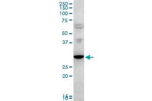 FAIM2 polyclonal antibody (A01), Lot # 051122JC01. (FAIM2 antibody  (AA 1-316))