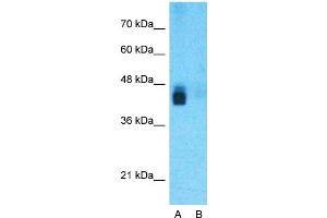 Host:  Rabbit  Target Name:  BACE1  Sample Type:  Human Fetal Liver  Lane A:  Primary Antibody  Lane B:  Primary Antibody + Blocking Peptide  Primary Antibody Concentration:  1ug/ml  Peptide Concentration:  5ug/ml  Lysate Quantity:  25ug/lane/lane  Gel Concentration:  0.