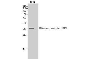 Western Blotting (WB) image for anti-Olfactory Receptor, Family 51, Subfamily F, Member 2 (OR51F2) (C-Term) antibody (ABIN3186117) (OR51F2 antibody  (C-Term))