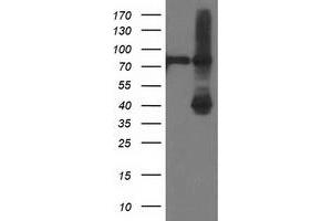 HEK293T cells were transfected with the pCMV6-ENTRY control (Left lane) or pCMV6-ENTRY ADH1B (Right lane) cDNA for 48 hrs and lysed. (ADH1B antibody)