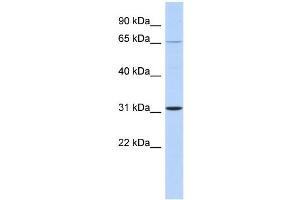 WB Suggested Anti-ZNF691 Antibody Titration:  0. (ZNF691 antibody  (Middle Region))