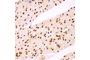 Immunohistochemistry of paraffin-embedded human colon using TEAD3 antibody (ABIN5975292) at dilution of 1/100 (40x lens). (TEAD3 antibody)