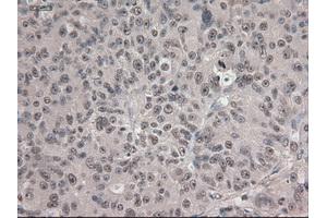 Immunohistochemical staining of paraffin-embedded colon using anti-Notch1 (ABIN2452671) mouse monoclonal antibody.