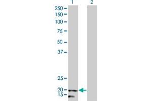 Western Blot analysis of NDUFB5 expression in transfected 293T cell line by NDUFB5 monoclonal antibody (M01), clone 5G5. (NDUFB5 antibody  (AA 95-189))