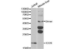 Western blot analysis of extracts of various cell lines, using ICOS antibody.
