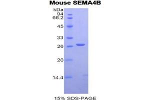 SDS-PAGE (SDS) image for Sema Domain, Immunoglobulin Domain (Ig), Transmembrane Domain (TM) and Short Cytoplasmic Domain, (Semaphorin) 4B (SEMA4B) protein (ABIN3011612)