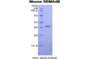 SDS-PAGE analysis of Mouse Semaphorin 4B Protein. (SEMA4B Protein)