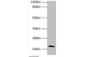 Western blot All lanes: Protein SSX2 antibody at 2 μg/mL + MDA-MB-231 whole cell lysate Secondary Goat polyclonal to rabbit IgG at 1/10000 dilution Predicted band size: 22, 26 kDa Observed band size: 22 kDa (SSX2 antibody  (AA 1-188))