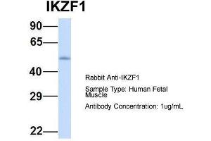 Host:  Rabbit  Target Name:  IKZF1  Sample Type:  Human Fetal Muscle  Antibody Dilution:  1. (IKZF1 antibody  (Middle Region))