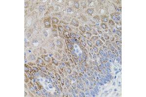 Immunohistochemistry of paraffin-embedded human esophagus using SM antibody (ABIN1682808, ABIN5663732, ABIN5663734 and ABIN6213914) (40x lens). (SMAD5 antibody  (AA 140-240))