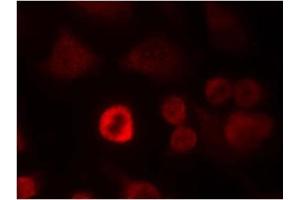 Image no. 1 for anti-Synuclein, alpha (SNCA) (Tyr136) antibody (ABIN319340) (SNCA antibody  (Tyr136))