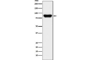 anti-Prothrombin Fragment 2 antibody