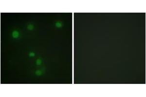 Immunofluorescence analysis of HuvEc cells, using Retinoblastoma (Ab-826) Antibody. (Retinoblastoma Protein (Rb) antibody  (AA 601-650))