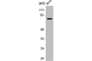 Western Blotting (WB) image for anti-Solute Carrier Organic Anion Transporter Family, Member 1A2 (SLCO1A2) (Internal Region) antibody (ABIN7187565)